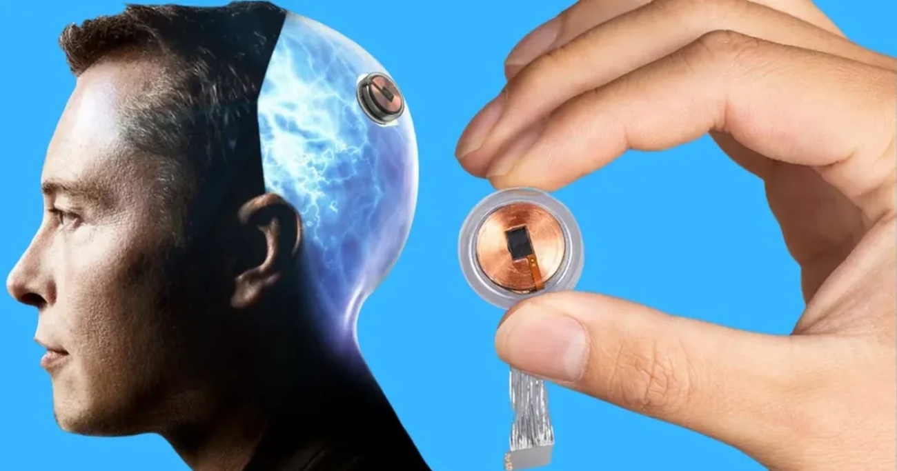 Elon Musk’s Neuralink Brain Implant Approved For Human Trails Glancy News