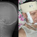 Scientist Claims He Performed Brain Surgery on Himself in Living Room